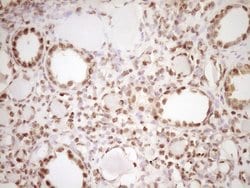 Invitrogen LPIN1 Monoclonal Antibody (OTI8F10) 100 &mu;L; Unconjugated:Antibodies,