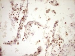 Invitrogen LPIN1 Monoclonal Antibody (OTI8F10) 100 &mu;L; Unconjugated:Antibodies,