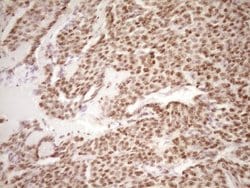 Invitrogen LPIN1 Monoclonal Antibody (OTI8F10) 100 &mu;L; Unconjugated:Antibodies,