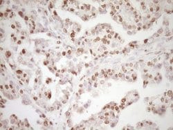 Invitrogen LPIN1 Monoclonal Antibody (OTI8F10) 100 &mu;L; Unconjugated:Antibodies,