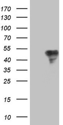 Invitrogen TFPI Monoclonal Antibody (OTI4H9) 100 &mu;L; Unconjugated:Antibodies,