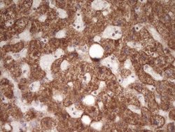 Invitrogen LRRC6 Monoclonal Antibody (OTI7E9) 100 &mu;L; Unconjugated:Antibodies,