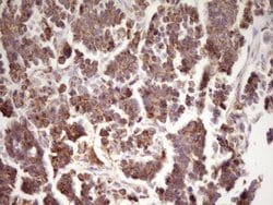 Invitrogen LRRC6 Monoclonal Antibody (OTI7E9) 100 &mu;L; Unconjugated:Antibodies,