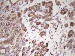Invitrogen LRRC6 Monoclonal Antibody (OTI7E9) 100 &mu;L; Unconjugated:Antibodies,