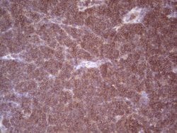 Angiopoietin 2 Monoclonal Antibody (OTI3H7), Invitrogen 100 &mu;L; Unconjugated:Antibodies,