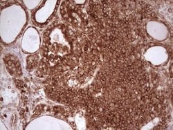 Invitrogen WIBG Monoclonal Antibody (OTI9C7) 100 &mu;L; Unconjugated:Antibodies,