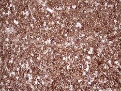 Invitrogen WIBG Monoclonal Antibody (OTI9C7) 100 &mu;L; Unconjugated:Antibodies,