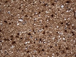 Invitrogen DCLK1 Monoclonal Antibody (OTI1F8) 100 &mu;L; Unconjugated:Antibodies,