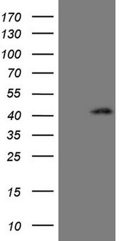 Invitrogen CTGF Monoclonal Antibody (OTI6D1) 100 &mu;L; Unconjugated:Antibodies,