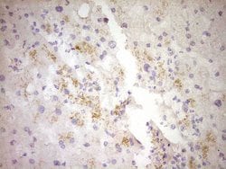 Invitrogen CTGF Monoclonal Antibody (OTI4B12) 100 &mu;L; Unconjugated:Antibodies,