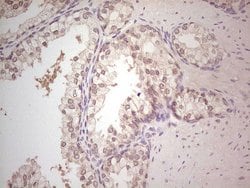 Invitrogen Hairless Monoclonal Antibody (OTI1D9) 100 &mu;L; Unconjugated:Antibodies,