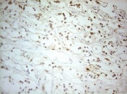 Invitrogen ALOX5 Monoclonal Antibody (OTI2C5) 100 &mu;L; Unconjugated:Antibodies,