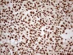 Invitrogen ALOX5 Monoclonal Antibody (OTI3F1) 100 &mu;L; Unconjugated:Antibodies,