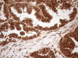 Invitrogen ALOX5 Monoclonal Antibody (OTI3F1) 100 &mu;L; Unconjugated:Antibodies,