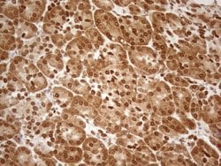 Invitrogen ALOX5 Monoclonal Antibody (OTI3F1) 100 &mu;L; Unconjugated:Antibodies,