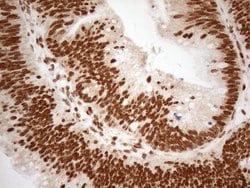 Invitrogen ALOX5 Monoclonal Antibody (OTI3F1) 100 &mu;L; Unconjugated:Antibodies,