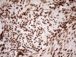 Invitrogen ALOX5 Monoclonal Antibody (OTI3F1) 100 &mu;L; Unconjugated:Antibodies,