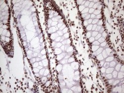 Invitrogen 53BP1 Monoclonal Antibody (OTI2H6) 100 &mu;L; Unconjugated:Antibodies,