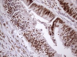 Invitrogen 53BP1 Monoclonal Antibody (OTI2H6) 100 &mu;L; Unconjugated:Antibodies,