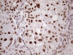 Invitrogen 53BP1 Monoclonal Antibody (OTI2H6) 100 &mu;L; Unconjugated:Antibodies,