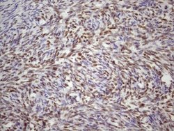 Invitrogen 53BP1 Monoclonal Antibody (OTI2H6) 100 &mu;L; Unconjugated:Antibodies,