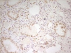 HMG20A Monoclonal Antibody (OTI5E3):Antibodies, Monoclonal