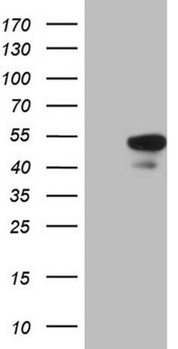 HMG20A Monoclonal Antibody (OTI5E3):Antibodies, Monoclonal