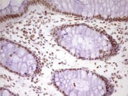 Invitrogen HMG20A Monoclonal Antibody (OTI2H4) 100 &mu;L; Unconjugated:Antibodies,