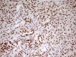 Invitrogen HMG20A Monoclonal Antibody (OTI2H4) 100 &mu;L; Unconjugated:Antibodies,