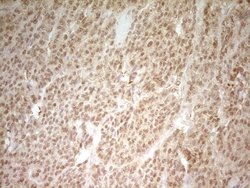 Invitrogen HMG20A Monoclonal Antibody (OTI1C2) 100 &mu;L | Buy Online | Invitrogen&trade; | Fisher Scientific