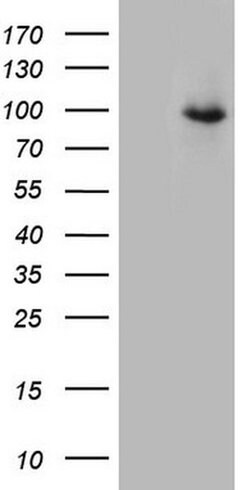Invitrogen CD248 Monoclonal Antibody (OTI1H6) 100 &mu;L; Unconjugated:Antibodies,