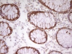 Invitrogen PAPSS2 Monoclonal Antibody (OTI3H10) 100 &mu;L; Unconjugated:Antibodies,
