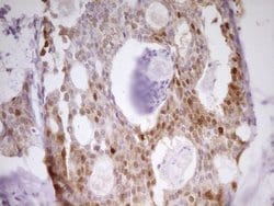 Invitrogen PAPSS2 Monoclonal Antibody (OTI2E7) 100 &mu;L; Unconjugated:Antibodies,