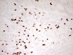 Invitrogen Myeloid Specific Antigen Monoclonal Antibody (OTI4H6) 100 &mu;L;