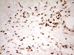 Invitrogen Myeloid Specific Antigen Monoclonal Antibody (OTI4H6) 100 &mu;L;