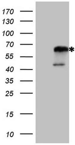 Invitrogen NR2C2 Monoclonal Antibody (OTI1F3) 100 &mu;L; Unconjugated:Antibodies,