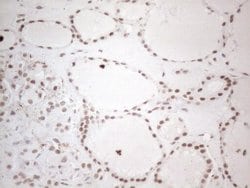 Invitrogen NR2C2 Monoclonal Antibody (OTI4B1) 100 &mu;L; Unconjugated:Antibodies,
