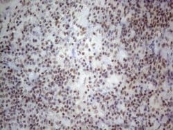 Invitrogen NR2C2 Monoclonal Antibody (OTI4B1) 100 &mu;L; Unconjugated:Antibodies,