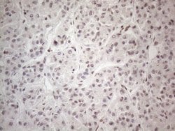 Invitrogen NR2C2 Monoclonal Antibody (OTI4B1) 100 &mu;L; Unconjugated:Antibodies,