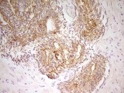 Invitrogen PAK4 Monoclonal Antibody (OTI1C7) 100 &mu;L; Unconjugated:Antibodies,
