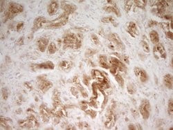 Invitrogen PAK4 Monoclonal Antibody (OTI1C7) 100 &mu;L; Unconjugated:Antibodies,