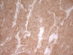 Invitrogen PAK4 Monoclonal Antibody (OTI1C7) 100 &mu;L; Unconjugated:Antibodies,