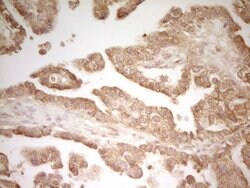 Invitrogen PAK4 Monoclonal Antibody (OTI1C7) 100 &mu;L; Unconjugated:Antibodies,