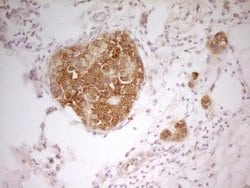 Invitrogen PAK4 Monoclonal Antibody (OTI1C7) 100 &mu;L; Unconjugated:Antibodies,