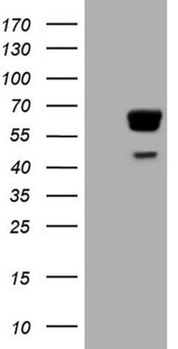 Invitrogen PAK4 Monoclonal Antibody (OTI1C7) 100 &mu;L; Unconjugated:Antibodies,