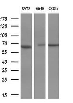 Invitrogen PAK4 Monoclonal Antibody (OTI1C7) 100 &mu;L; Unconjugated:Antibodies,