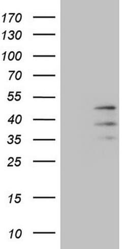 Invitrogen PISD Monoclonal Antibody (OTI3B11) 100 &mu;L | Buy Online | Invitrogen&trade; | Fisher Scientific