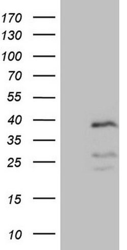 PISD Monoclonal Antibody (OTI4G5) 100 &mu;L | Buy Online | Thermo Scientific | Fisher Scientific