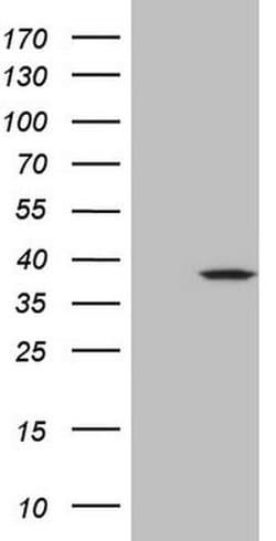 Invitrogen MRPL15 Monoclonal Antibody (OTI7A3) 100 &mu;L; Unconjugated:Antibodies,