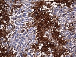 Invitrogen Carboxypeptidase M Monoclonal Antibody (OTI4E11) 100 &mu;L;